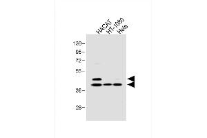 All lanes : Anti-SD3 Antibody at 1:1000 dilution Lane 1: HACAT whole cell lysate Lane 2: HT-1080 whole cell lysate Lane 3: Hela whole cell lysate Lysates/proteins at 20 μg per lane. (SMAD3 Antikörper  (pSer213))