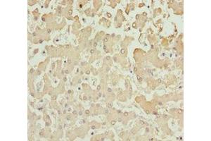 Immunohistochemistry of paraffin-embedded human liver tissue using ABIN7143586 at dilution of 1:100 (AKR7A2 Antikörper  (AA 100-359))