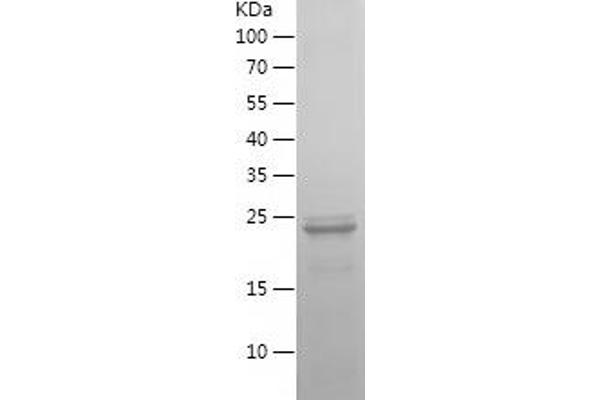 IRF5 Protein (AA 1-200) (His tag)