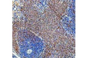 anti-Spleen tyrosine Kinase (SYK) (AA 10-635) antibody