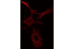 ABIN6277654 staining HeLa cells by IF/ICC. (MLKL Antikörper  (Internal Region))