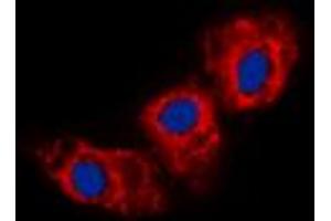 Immunofluorescent analysis of Cadherin 23 staining in HEK293T cells.