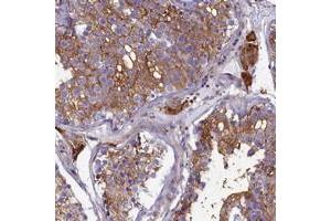 Immunohistochemical staining of human testis with SLC26A10 polyclonal antibody  shows strong cytoplasmic positivity in cells in seminiferus ducts and Leydig cells at 1:200-1:500 dilution. (SLC26A10 Antikörper)