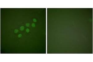 Immunofluorescence analysis of A549 cells, using SKP2/p45 Antibody.