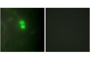 Immunofluorescence analysis of HeLa cells, using Dyskerin Antibody. (DKC1 Antikörper  (AA 171-220))