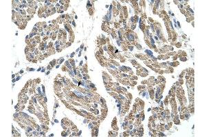 SLC25A38 antibody was used for immunohistochemistry at a concentration of 4-8 ug/ml to stain Skeletal muscle cells (arrows) in Human Muscle.