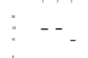 Human recombinant protein KIR2DL1, KIR2DL3 and KIR2DL4 (each 20ng per well) were resolved by SDS-PAGE, transferred to PVDF membrane and probed with anti-human KIR2DL4 (1:500).
