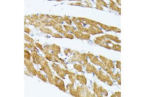 Immunohistochemistry of paraffin-embedded Rat brain using TR antibody (ABIN1683134, ABIN5664756, ABIN5664758 and ABIN6220605) at dilution of 1:100 (40x lens). (TRAP1 Antikörper  (AA 445-704))