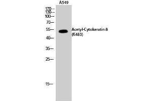 Western Blotting (WB) image for anti-Keratin 8 (KRT8) (acLys483) antibody (ABIN6285500) (KRT8 Antikörper  (acLys483))