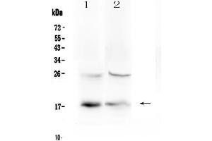 Western blot analysis of TSLP using anti-TSLP antibody .