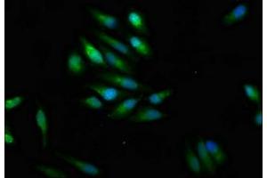 Immunofluorescence staining of Hela cells with ABIN7169929 at 1:100, counter-stained with DAPI. (SCN9A Antikörper  (AA 1849-1988))