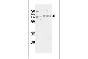 Western blot analysis of hG16L- 1817c in NIH-3T3, HepG2, Hela, Jurkat and NCI- cell line lysates (35 μg/lane). (ATG16L1 Antikörper  (C-Term))
