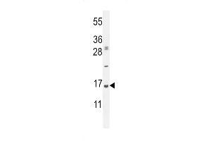Western blot analysis in Hela cell line lysates (35ug/lane). (UBA52 Antikörper  (C-Term))