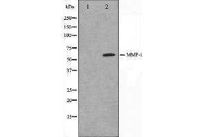 Western blot analysis on HepG2 cell lysate using MMP1 Antibody. (MMP1 Antikörper  (C-Term))