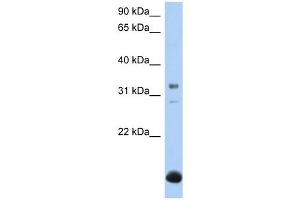 Western Blotting (WB) image for anti-UDP-Gal:betaGal beta 1,3-Galactosyltransferase Polypeptide 6 (B3GALT6) (N-Term) antibody (ABIN636025)