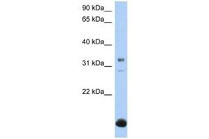 B3GALT6 antibody used at 1 ug/ml to detect target protein.