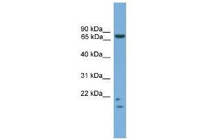 WB Suggested Anti-MRE11A Antibody Titration: 0. (Mre11 Antikörper  (N-Term))