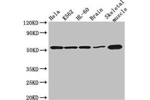 Western Blot Positive WB detected in: Hela whole cell lysate, K562 whole cell lysate, HL60 whole cell lysate, Mouse brain tissue, Mouse skeletal muscle tissue All lanes: ZBTB43 antibody at 3 μg/mL Secondary Goat polyclonal to rabbit IgG at 1/50000 dilution Predicted band size: 53 kDa Observed band size: 53 kDa (ZBTB43 Antikörper  (AA 165-467))