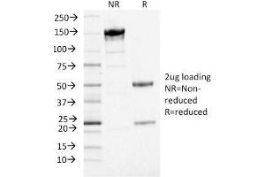 SDS-PAGE Analysis Purified PD-L1 Mouse Monoclonal Antibody (PDL1/2746) (unconjugated). (PD-L1 Antikörper  (AA 39-191) (PE))
