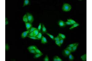 Immunofluorescence staining of HepG2 cells with ABIN7156004 at 1:133, counter-stained with DAPI. (HMGCS2 Antikörper  (AA 426-508))