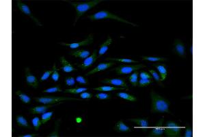 Immunofluorescence of purified MaxPab antibody to IFNA17 on HeLa cell. (IFNA17 Antikörper  (AA 1-189))