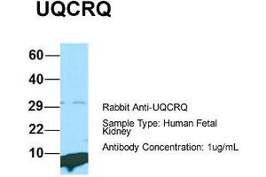 Host: Rabbit  Target Name: UQCRQ  Sample Tissue: Human Fetal Kidney  Antibody Dilution: 1.
