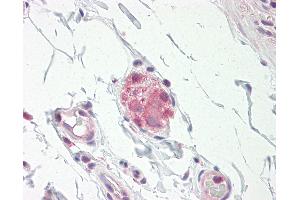 Anti-NOS1 / nNOS antibody IHC staining of human small intestine, submucosal plexus.
