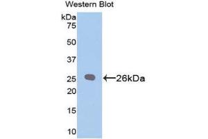 Western Blotting (WB) image for anti-B-Cell CLL/lymphoma 2 (BCL2) (AA 2-208) antibody (ABIN1858119) (Bcl-2 Antikörper  (AA 2-208))