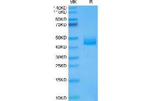 Human IL-12B on Tris-Bis PAGE under reduced condition. (IL12B Protein (AA 23-328) (His tag))