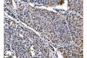 IHC analysis of SAP18 using anti-SAP18 antibody (ABIN7599009).