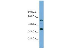 Image no. 1 for anti-Cytochrome P450, Family 26, Subfamily B, Polypeptide 1 (CYP26B1) (C-Term) antibody (ABIN6744176) (CYP26B1 Antikörper  (C-Term))
