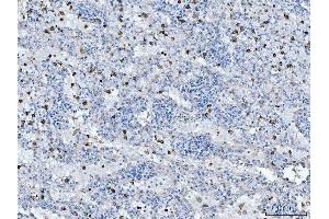 IHC analysis of CD14 using anti-CD14 antibody (ABIN7600531). (CD14 Antikörper  (AA 20-259))