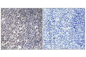Immunohistochemistry (IHC) image for anti-Mitochondrial Ribosomal Protein S16 (MRPS16) (Internal Region) antibody (ABIN1850528) (MRPS16 Antikörper  (Internal Region))