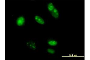 Immunofluorescence of purified MaxPab antibody to TRFP on HeLa cell. (MED20 Antikörper  (AA 1-212))