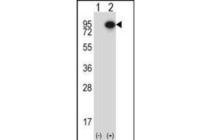 Western blot analysis of CTTN (arrow) using rabbit polyclonal CTTN Antibody (Center) (ABIN657649 and ABIN2846644). (Cortactin Antikörper  (AA 273-302))