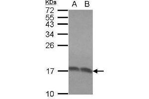 WB Image Sample (30 ug of whole cell lysate) A: Molt-4 B: Raji 15% SDS PAGE antibody diluted at 1:1000 (RPLP2 Antikörper  (Center))