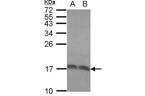 RPLP2 anticorps  (Center)