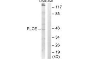 Western blot analysis of extracts from LOVO cells, using AGPAT5 Antibody. (AGPAT5 Antikörper  (AA 241-290))