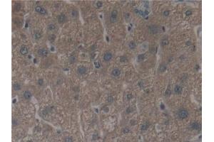 Detection of ALOX12 in Human Liver Tissue using Polyclonal Antibody to Arachidonate-12-Lipoxygenase (ALOX12) (ALOX12 Antikörper  (AA 352-656))