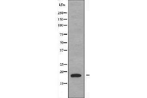 Western blot analysis of extracts from K562 cells, using PBOV1 antibody. (PBOV1 Antikörper  (Internal Region))