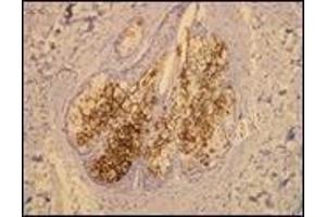 Immunohistochemistry (IHC) image for anti-Mucin 1 (MUC1) (C-Term) antibody (ABIN870418) (MUC1 Antikörper  (C-Term))