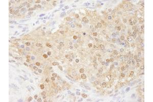anti-WD Repeat Domain 77 (WDR77) (AA 292-342) antibody