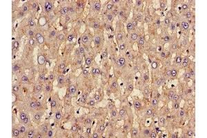 Immunohistochemistry of paraffin-embedded human liver tissue using ABIN7170002 at dilution of 1:100 (GLUT1 Antikörper  (AA 263-458))
