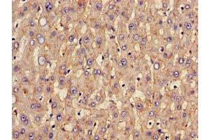 Immunohistochemistry of paraffin-embedded human liver tissue using ABIN7170002 at dilution of 1:100 (GLUT1 Antikörper  (AA 263-458))