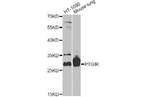 Western blot analysis of extracts of various cell lines, using PTGIR antibody (ABIN5970948) at 1/1000 dilution. (Prostacyclin Receptor Antikörper)