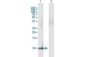 Western Blot analysis of HEPN1 expression in transfected 293T cell line by HEPN1 MaxPab polyclonal antibody.