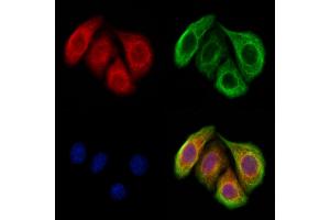 ABIN7094435 and ABIN7098483 staining Hela cells by IF/ICC. (METTL5 Antikörper  (Internal Region))