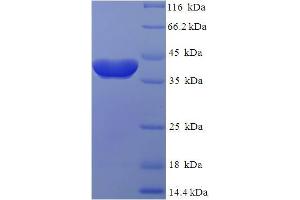 SDS-PAGE (SDS) image for RAB2A, Member RAS Oncogene Family (RAB2A) (AA 2-212) protein (His-SUMO Tag) (ABIN5710205) (RAB2A Protein (AA 2-212) (His-SUMO Tag))
