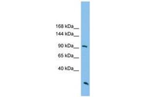 Image no. 1 for anti-rho GTPase Activating Protein 30 (ARHGAP30) (AA 287-336) antibody (ABIN6745064) (ARHGAP30 Antikörper  (AA 287-336))