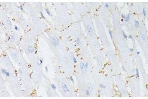 Immunohistochemistry of paraffin-embedded Rat heart using Phospho-GJA1(S368) Polyclonal Antibody at dilution of 1:200 (40x lens). (Connexin 43/GJA1 Antikörper  (pSer368))